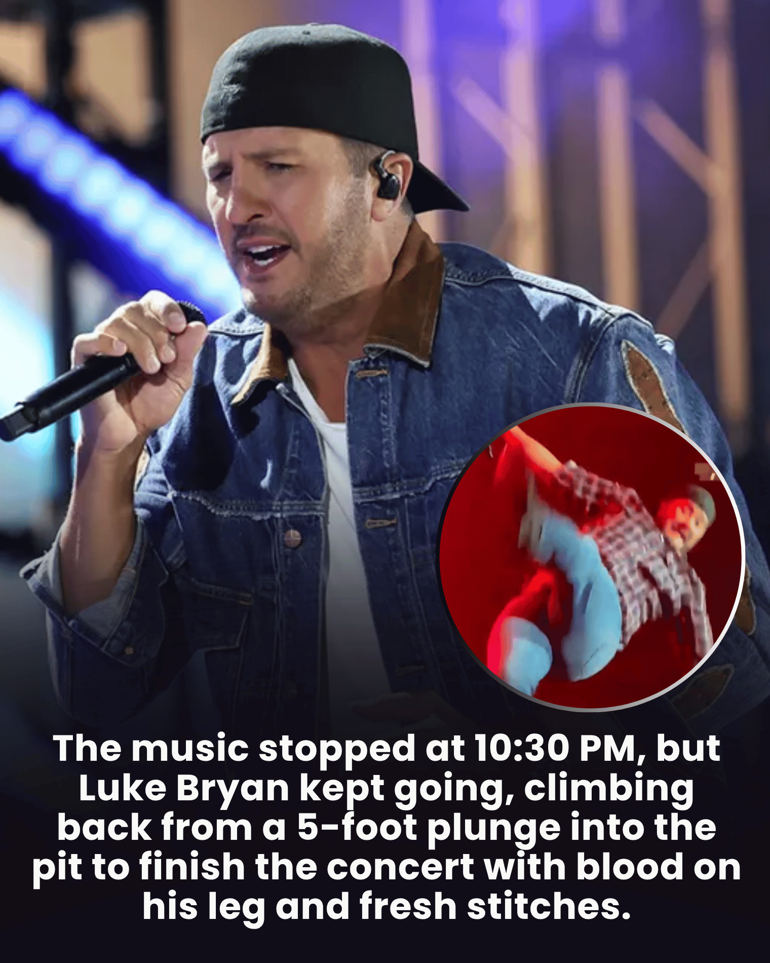 The music stopped at 10:30 PM, but Luke Bryan kept going, climbing back from a 5-foot plunge into the pit to finish the concert with blood on his leg and fresh stitches.