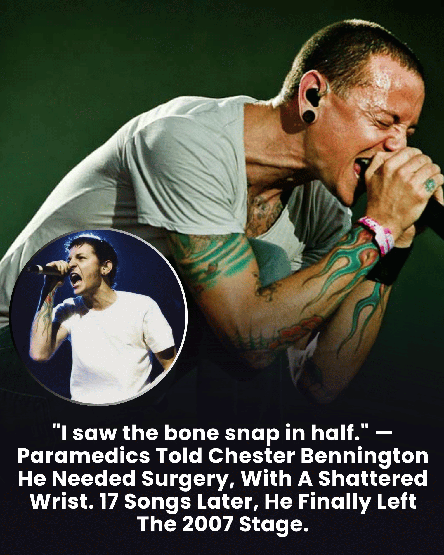 “I saw the bone snap in half.” — Paramedics Told Chester Bennington He Needed Surgery, With A Shattered Wrist. 17 Songs Later, He Finally Left The 2007 Stage.