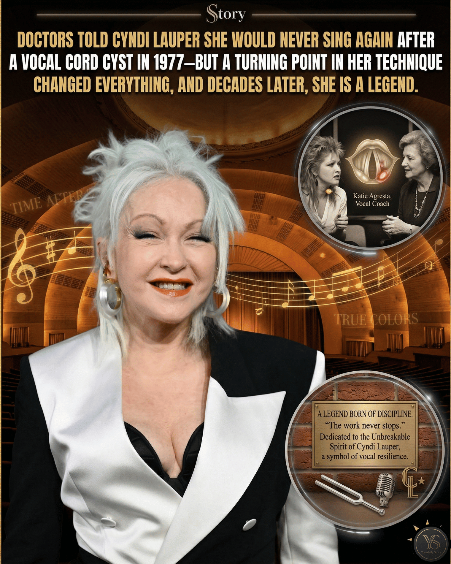 Doctors Told Cyndi Lauper She Would Never Sing Again After A Vocal Cord Cyst In 1977—But A Turning Point In Her Technique Changed Everything, And Decades Later, She Is A Legend.