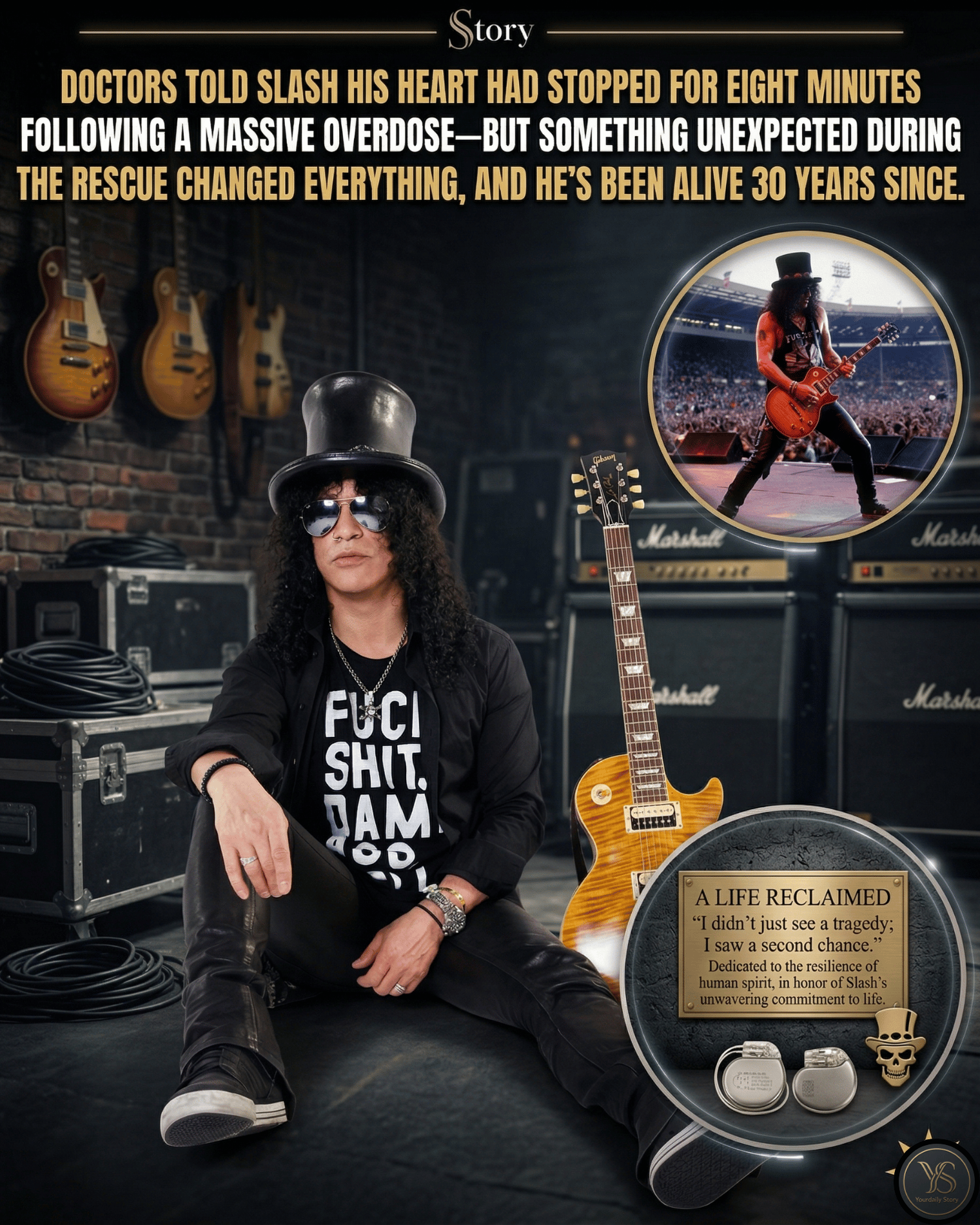 Doctors Told Slash His Heart Had Stopped For Eight Minutes Following A Massive Overdose—But Something Unexpected During The Rescue Changed Everything, And He’s Been Alive 30 Years Since.