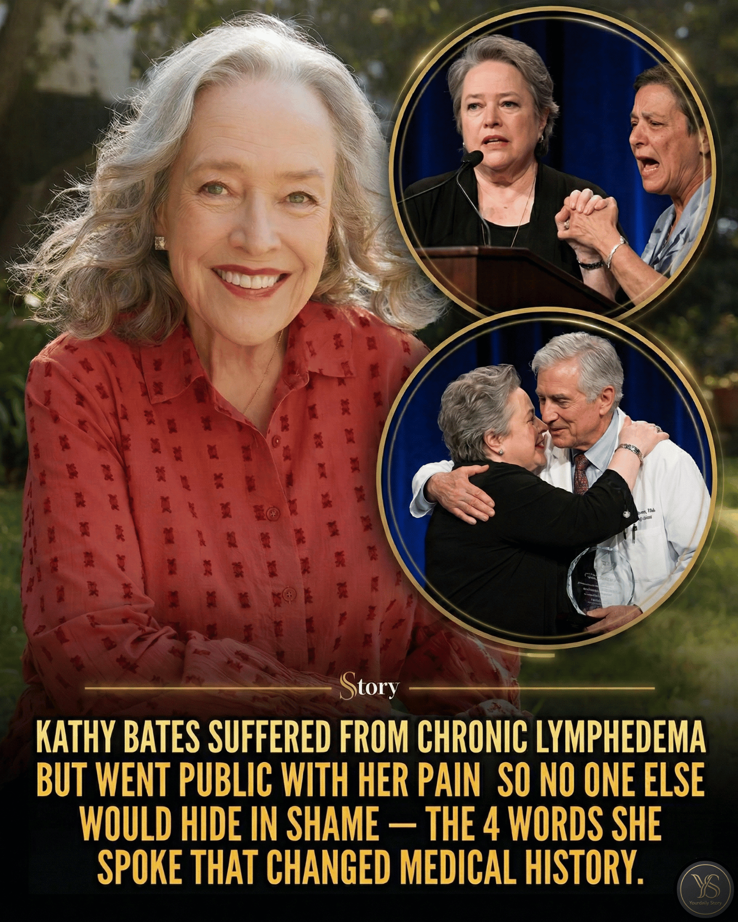 Kathy Bates Suffered From Chronic Lymphedema But Went Public With Her Pain So No One Else Would Hide In Shame — The 4 Words She Spoke That Changed Medical History.