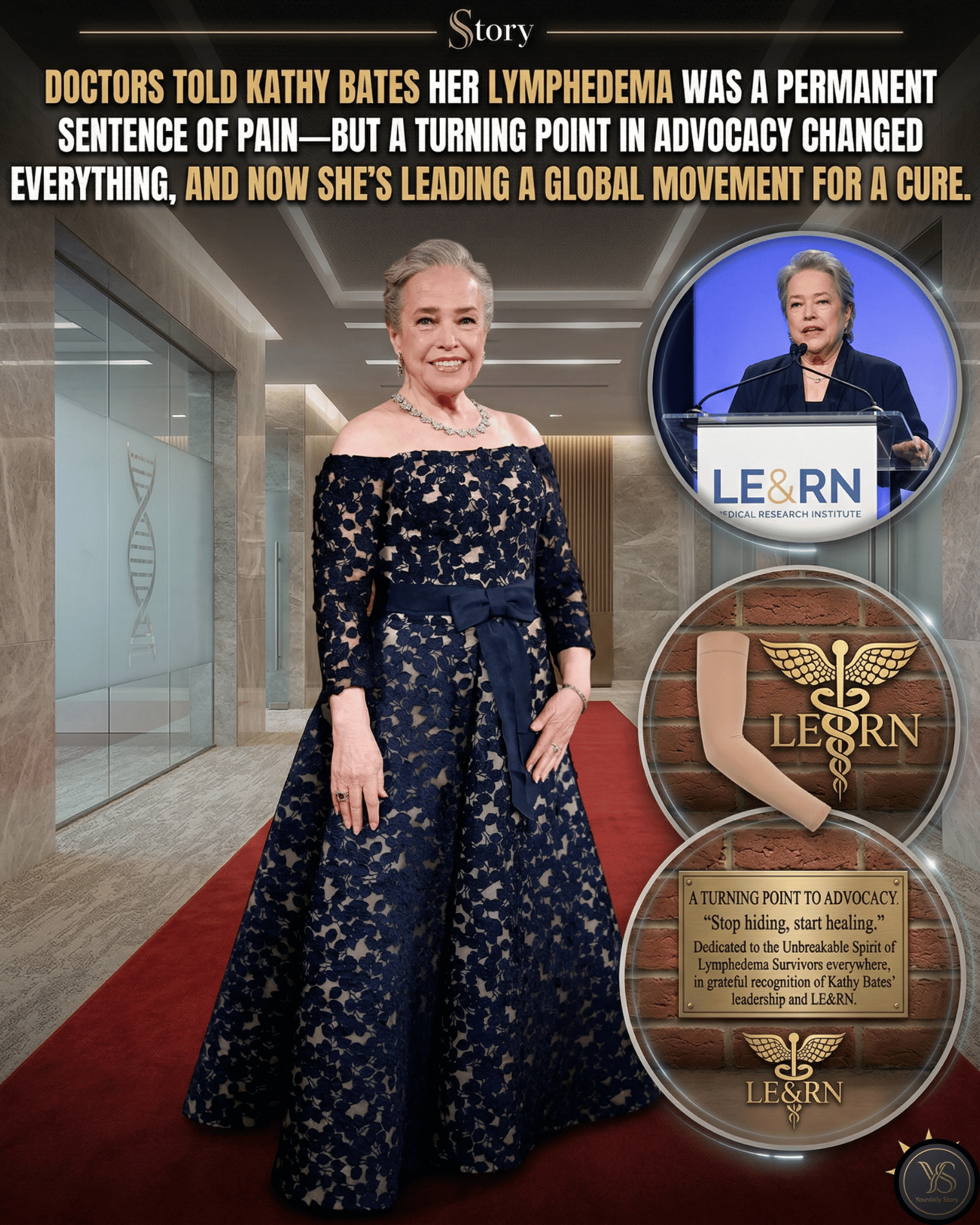 Doctors Told Kathy Bates Her Lymphedema Was A Permanent Sentence Of Pain—But A Turning Point In Advocacy Changed Everything, And Now She’s Leading A Global Movement For A Cure.
