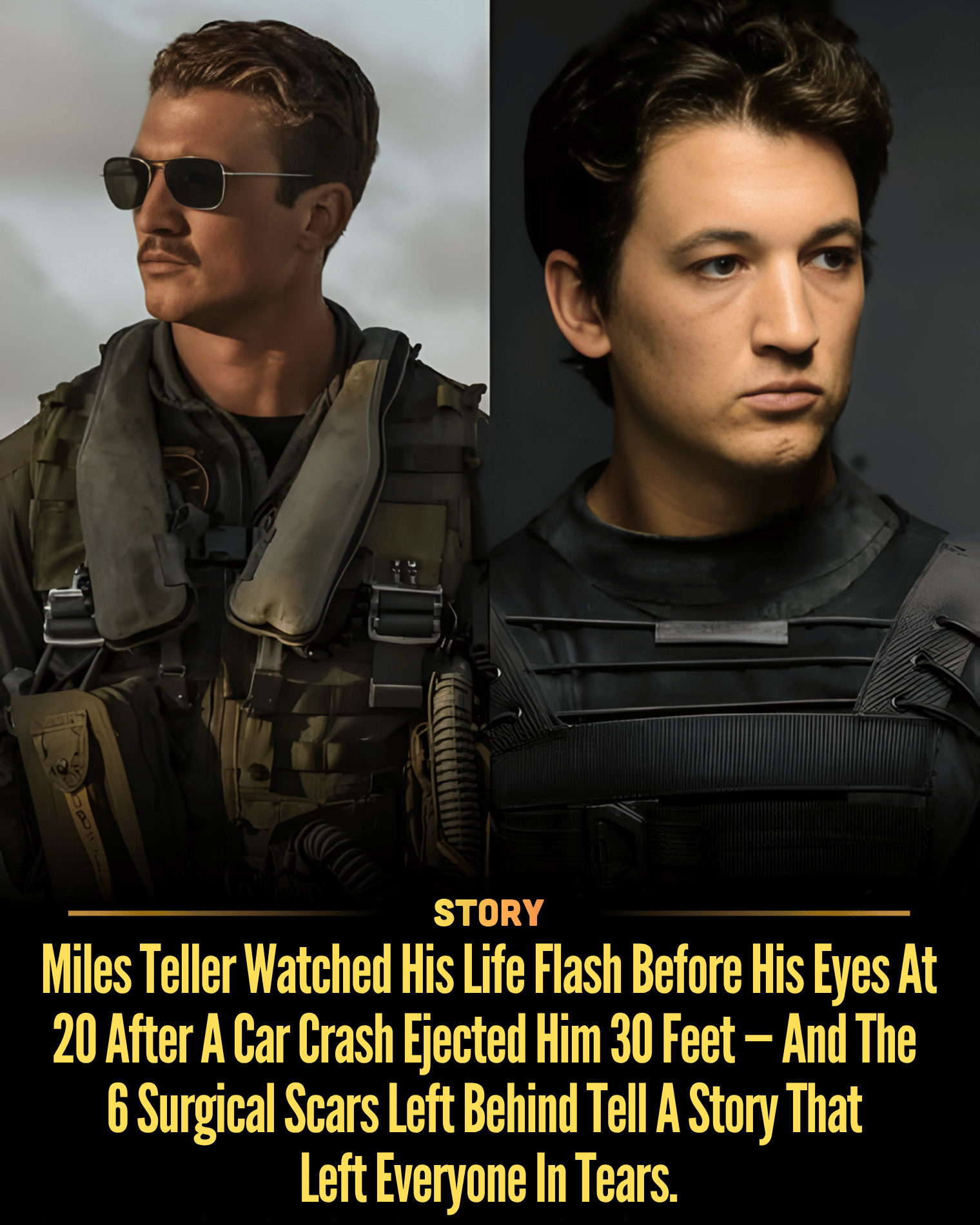 Miles Teller Watched His Life Flash Before His Eyes At 20 After A Car Crash Ejected Him 30 Feet — And The 6 Surgical Scars Left Behind Tell A Story That Left Everyone In Tears.