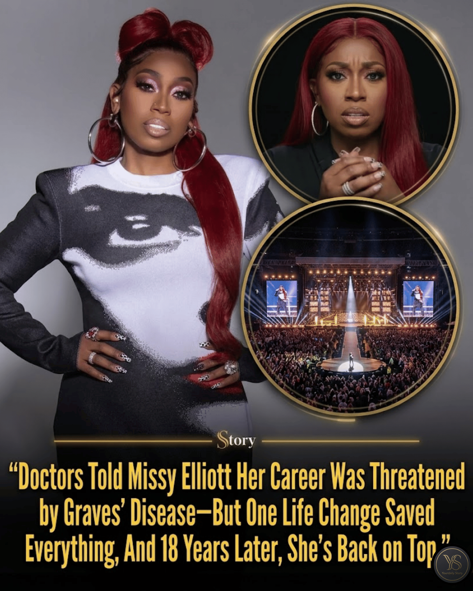 Doctors Told Missy Elliott Her Career Was Threatened by Graves’ Disease—But One Life Change Saved Everything, And 18 Years Later, She’s Back on Top.