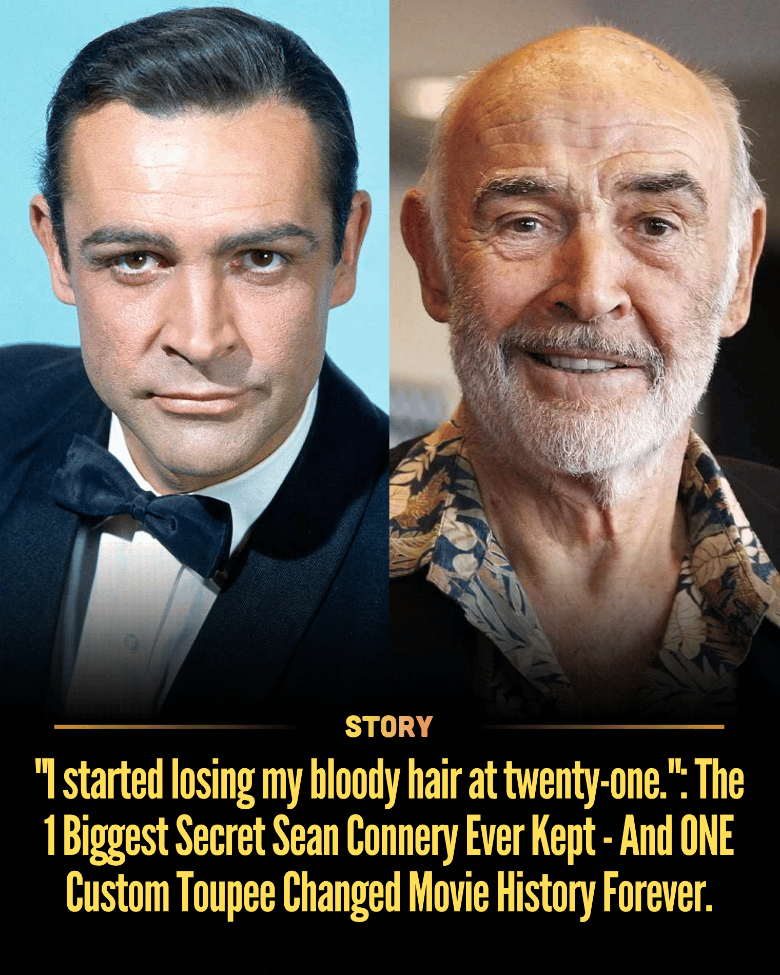 “I started losing my bloody hair at twenty-one.”: The 1 Biggest Secret Sean Connery Ever Kept – And ONE Custom Toupee Changed Movie History Forever.