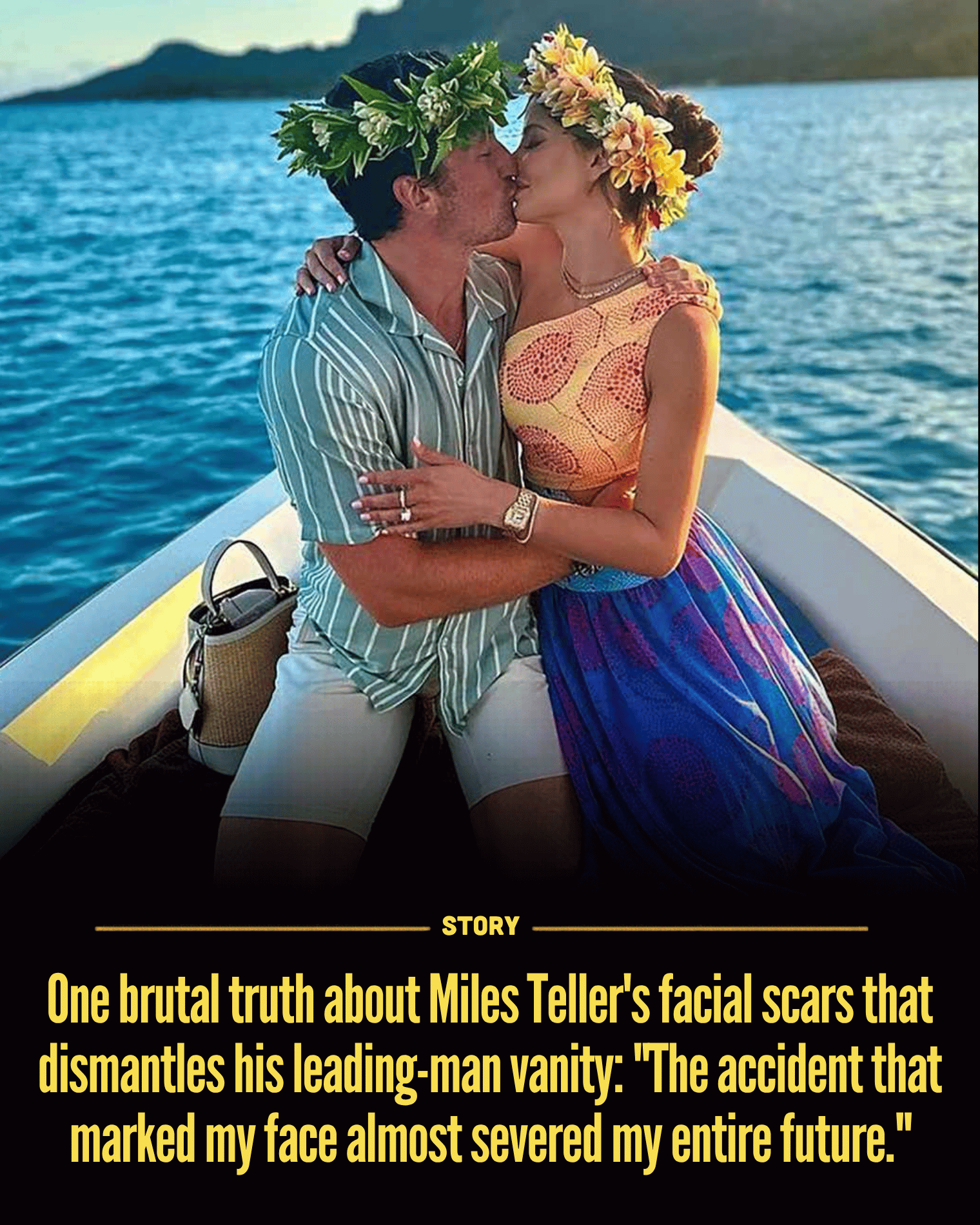 One brutal truth about Miles Teller’s facial scars that dismantles his leading-man vanity: “The accident that marked my face almost severed my entire future.”