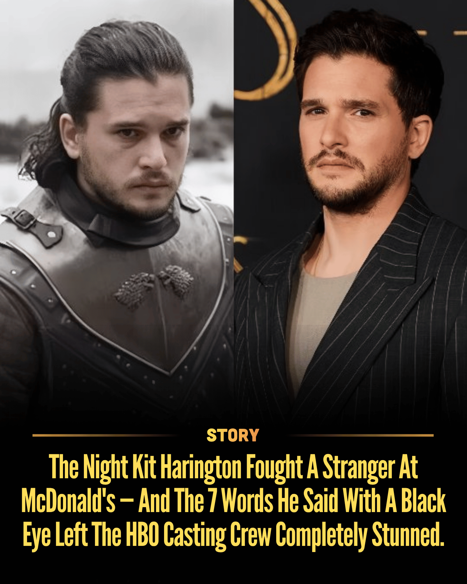 The Night Kit Harington Fought A Stranger At McDonald’s — And The 7 Words He Said With A Black Eye Left The HBO Casting Crew Completely Stunned.