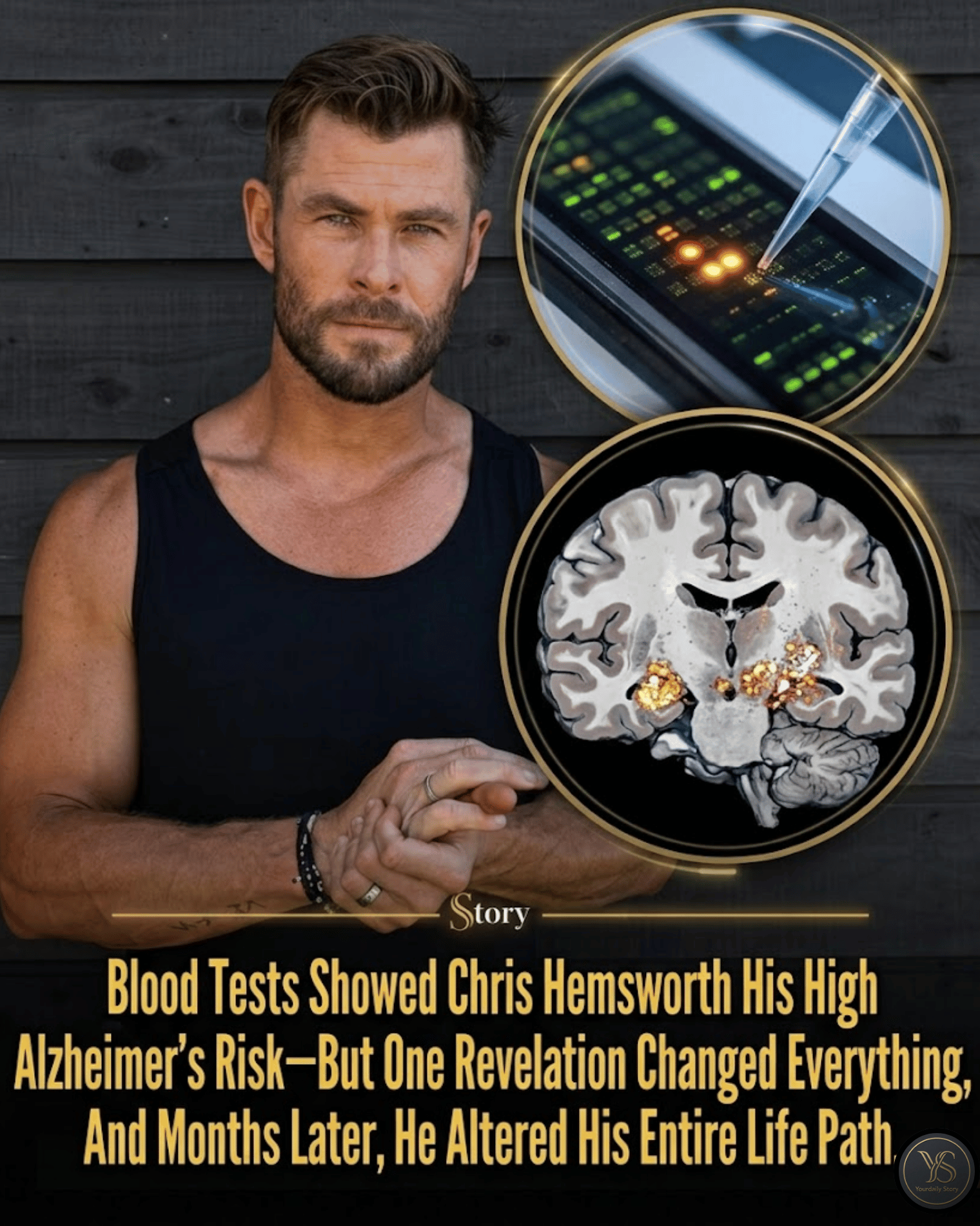 Blood Tests Showed Chris Hemsworth His High Alzheimer’s Risk—But One Revelation Changed Everything, And Months Later, He Altered His Entire Life Path.