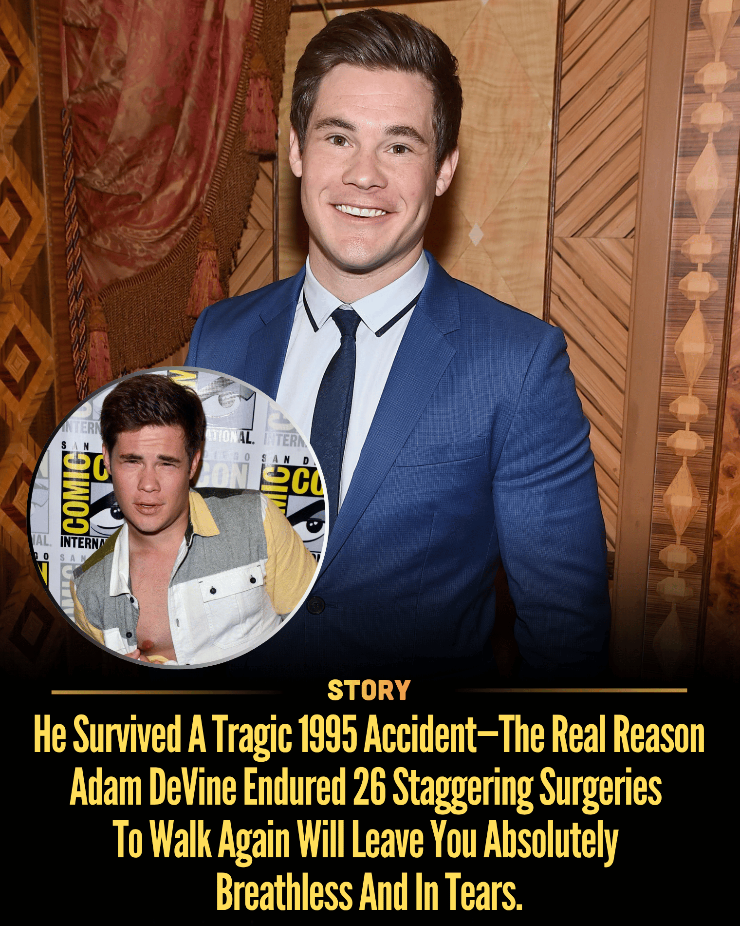 He Survived A Tragic 1995 Accident—The Real Reason Adam DeVine Endured 26 Staggering Surgeries To Walk Again Will Leave You Absolutely Breathless And In Tears.